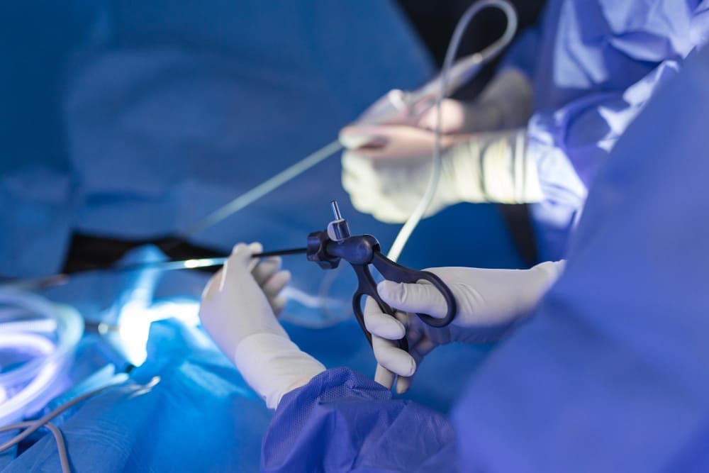 Cirugía laparoscópica y de mínima invasión en Puebla: Tecnología avanzada para recuperación más rápida
